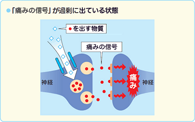 mechanism 1